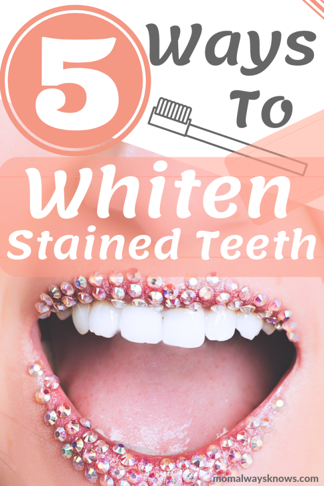 ways to whiten stained teeth